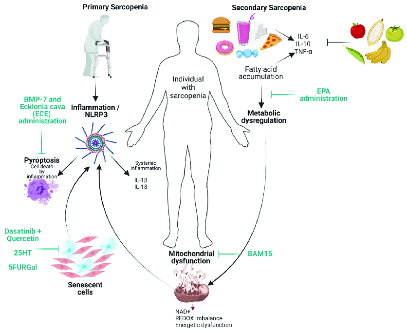 YOUR QUICK GUIDE ON SARCOPENIA: THE 'SILENT ROBBER' OF MUSCLE 4 Illustration of factors involved in primary and secondary sarcopenia New potential